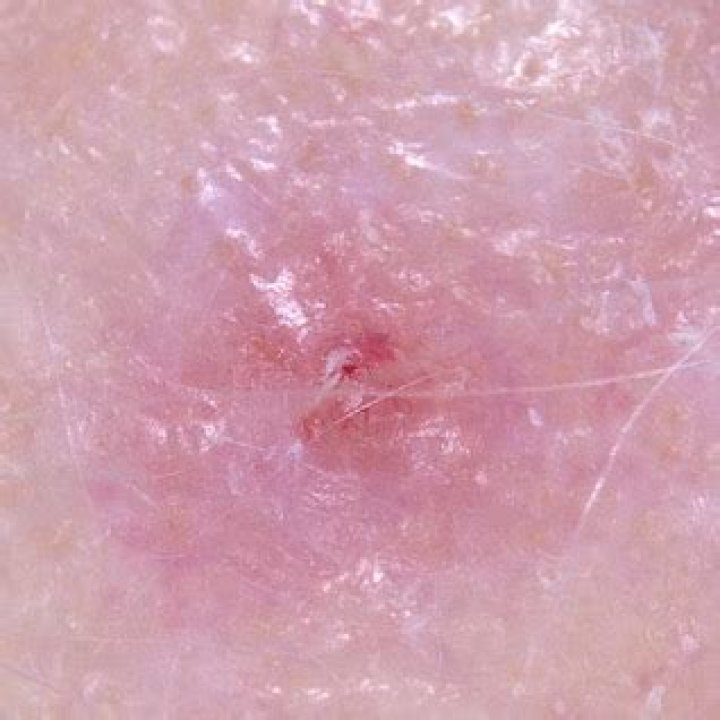 Nine sunscreen brands fail Consumer NZ’s latest test